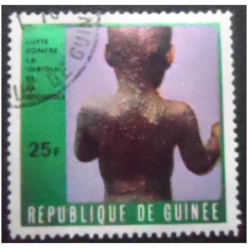 Imagem do selo postal da Rep. da Guiné de 1970 Child with Smallpox anunciado